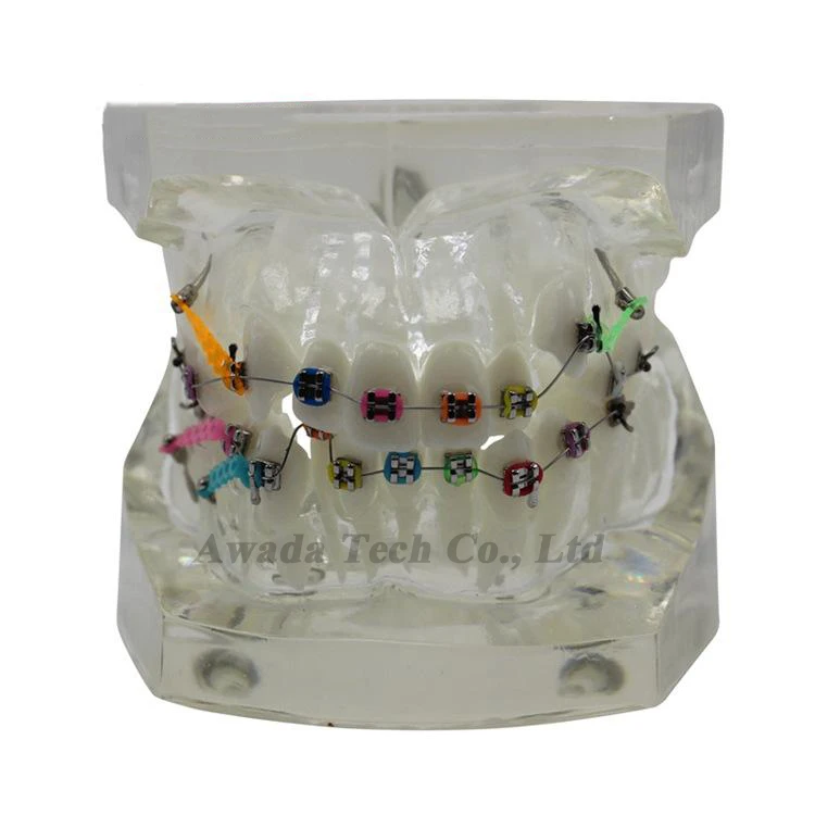 

Dentistry Orthodontic model Dental model Bracket display model,Dentist for Medical Science Teaching Teeth Whitening