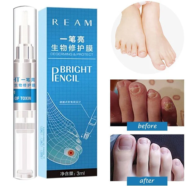 Hot Sale 3ml Nail Fungus Treatment Liquid Toenail Anti Fungal Nails Care Portable Nail rehydration solution
