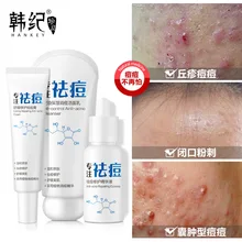 Salicylic Acid Гиалуроновая кислота Удаление Шрама от акне крем для лица особенно женский лечение акне наборы для лица Уход за кожей с сывороткой набор