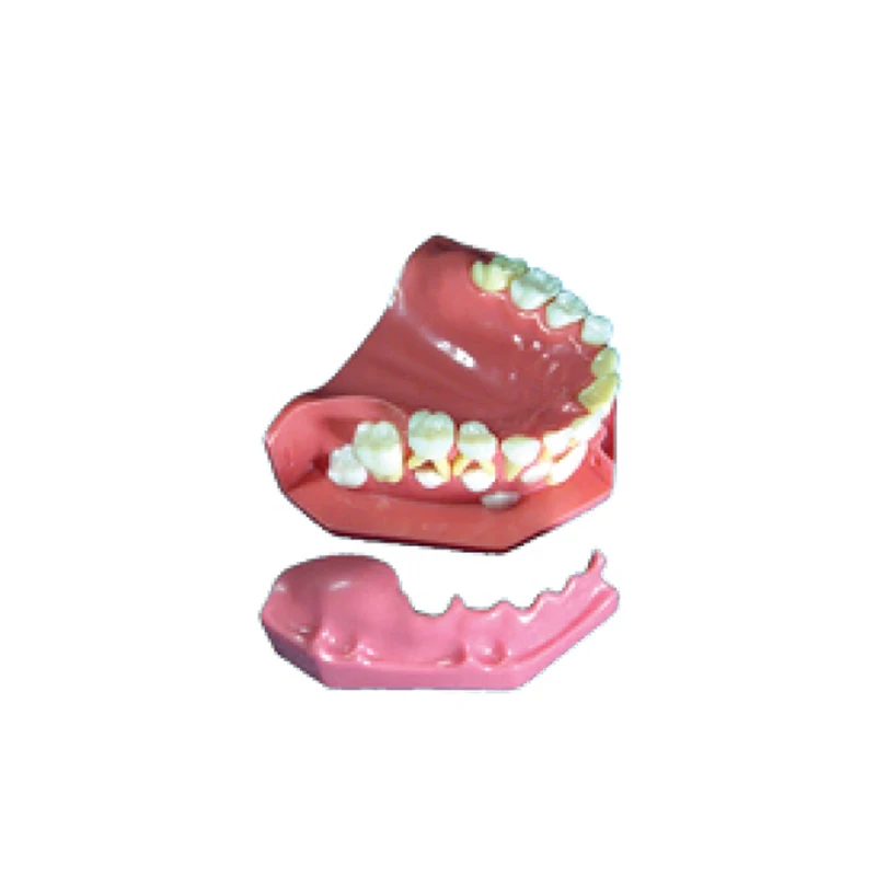 

Productos De Laboratorio Dental Show 3-6 Years Old Children's Teeth Development
