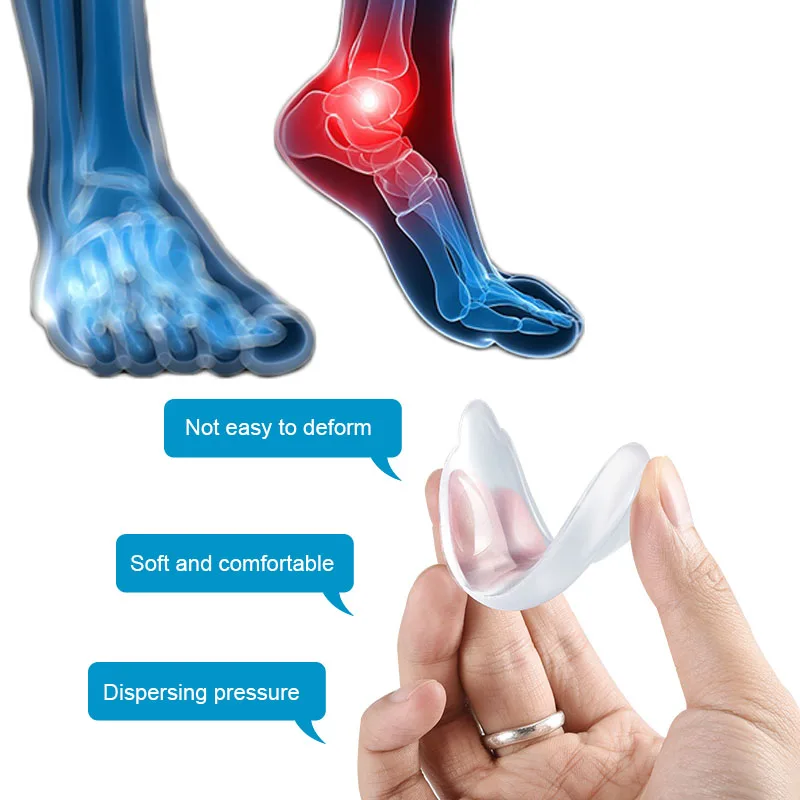 Soumit гель O/X тип ноги ортопедические стельки внутри снаружи ноги коррекции ортопедические пятки поддержка Вставки колодки для мужчин женщин
