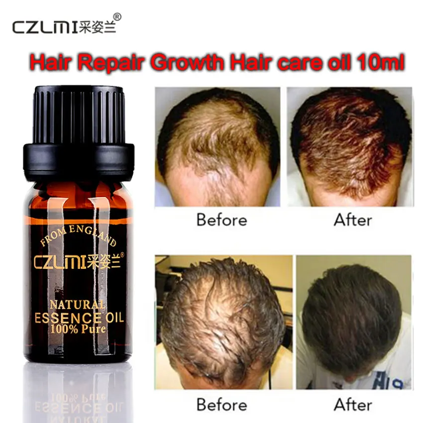 Hair Loss Product Natural Grow Hair Essential Oil Faster Regrowth Hair Growth serum Restoration Thickening Fibers Essence 10ML