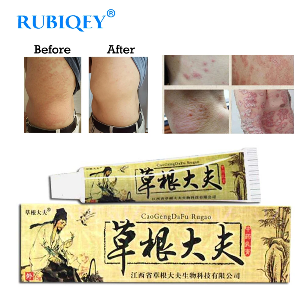 100% Natural Herbal Creams Body Psoriasis Cream Perfect For Dermatitis ...