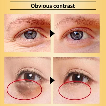 

24k Gold Anti Wrinkle Eye Essence Removal Dark Circles Anti-Aging Moisturizing Essence KG66