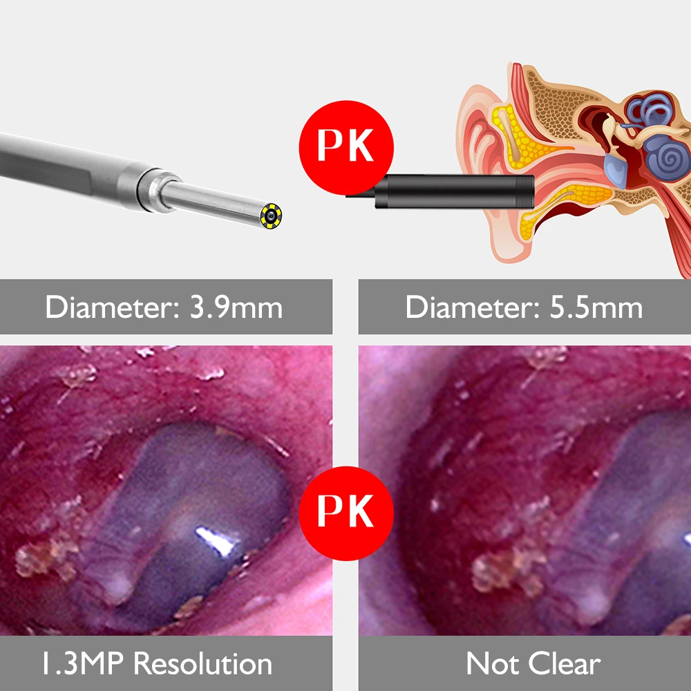 Беспроводной Wi-Fi ушной камеры HD объектив ушной палочки рассеивания тепла ушной отоскоп ушной воск инструмент для удаления визуального ушной палочки очиститель