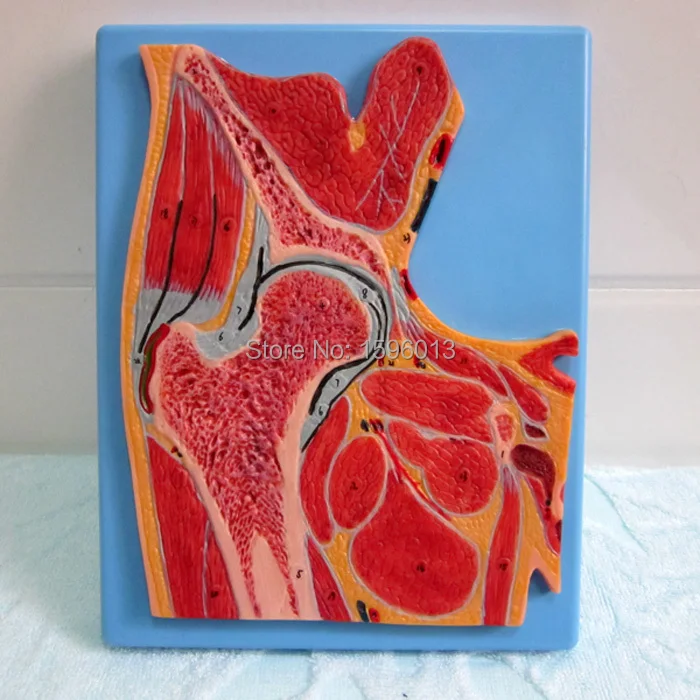 цена Hip Joint Section Model, Anatomical Hip Joint Model