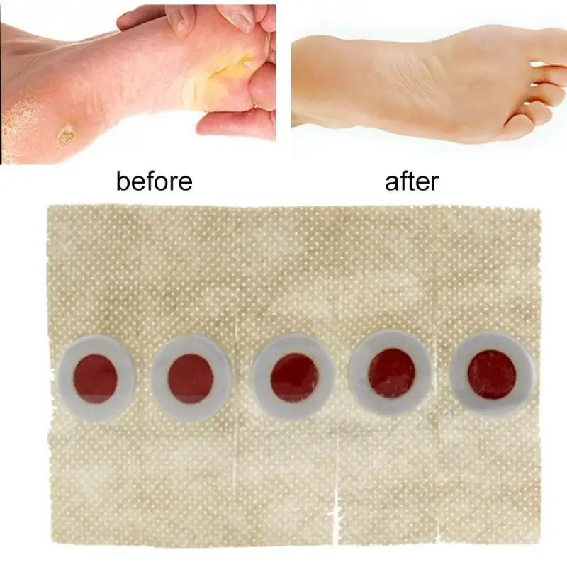 Инструмент для домашнего использования 40 шт. мозоли ног средство удаления
