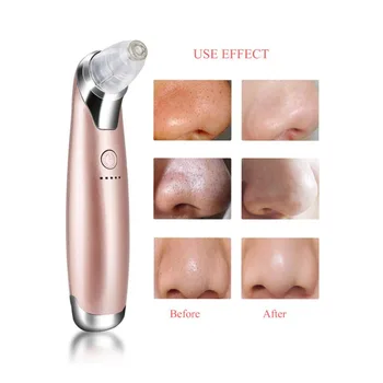 

Electric Vacuum Pore Cleaner 3 Color Facial Cleaner Blackhead Suction Removal Scar LED Face Skin Care Beauty Machine 5 Levels