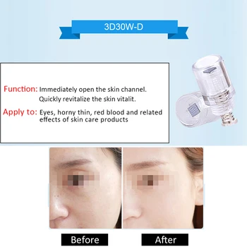 

3 Style Micro-needles For Skin Mezoroller Tool Pen Nano Blackhead remover Massager Spot Cleaner Facial Skin Care Instrument