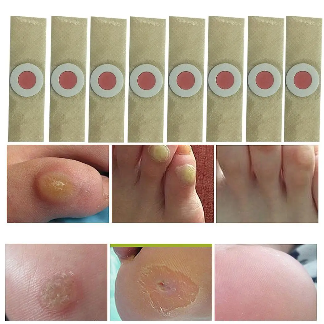 

50 Pcs Corn Plaster Painless Corn Remover Feet Khaki Care Warts Thorn Foot Removal Plaster Patch