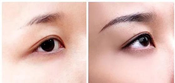 effect_brow