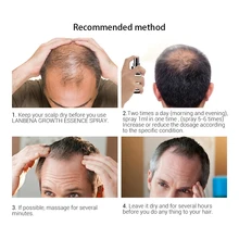 Новинка уход за корнями эссенция товары для роста волос питание волос против 20 мл спрей выпадение 3 прибыть шт эссенция