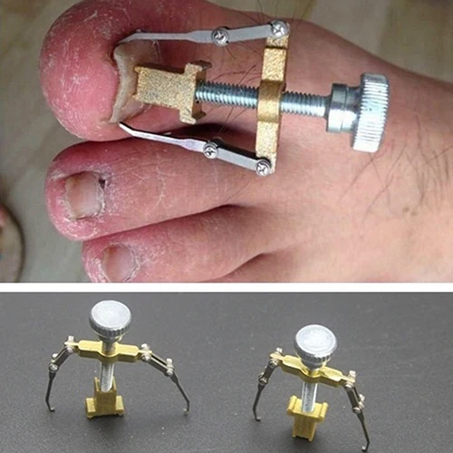 

Ingrown Toe Nail Correction Lifter Fixer Recover Pedicure Tool with Iron Box