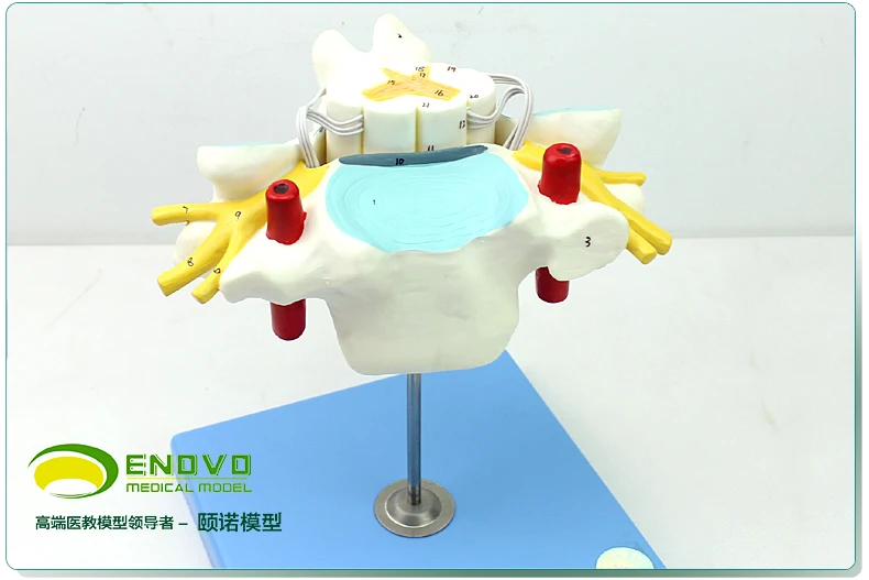 Authentic Medical Human Cervical Vertebra Model Spinal Cord and Spinal Nerve Enlargement Model Neurobiology Anatomical Model Authentic Medical Human Cervical Vertebra Model Spinal Cord and Spinal Nerve Enlargement Model Neurobiology Anatomical Model