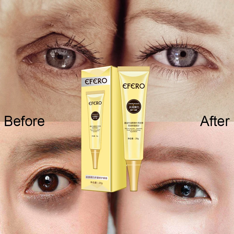 6PCS EFERO Skin Care Set Kit Eye Cream Moisturizing Dark Circles Remover Eye Patches Anti Aging Anti Puffiness Eyes Serum Care 6PCS EFERO Skin Care Set Kit Eye Cream Moisturizing Dark Circles Remover Eye Patches Anti Aging Anti Puffiness Eyes Serum Care