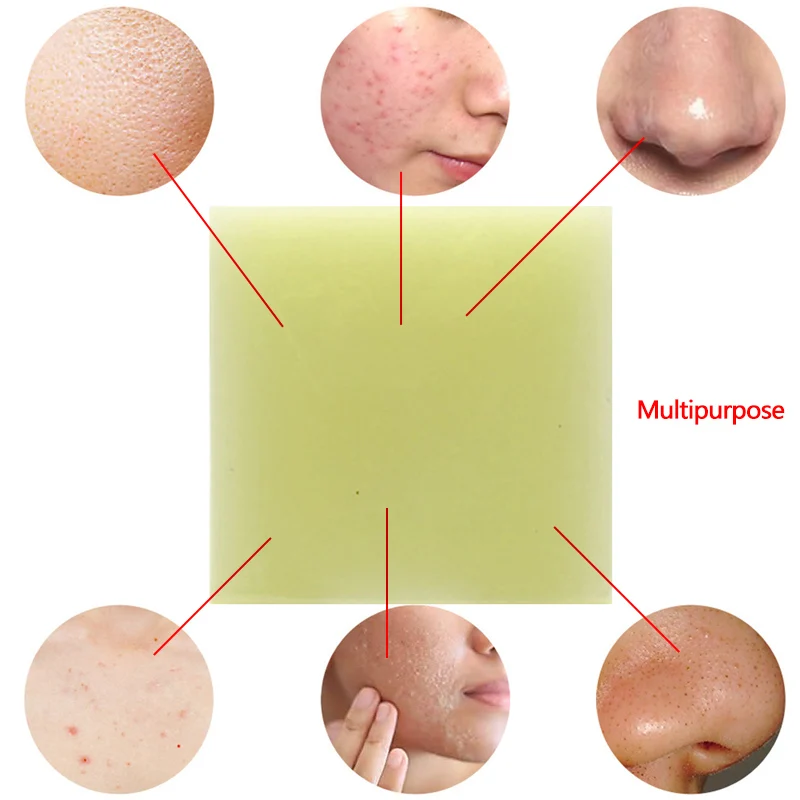 100g Sea Salt Handmade Soap Face Body Cleaner Removal Pimple Acne Treatment Skin Care Whitening Soap blanqueador piel jabones 100g Sea Salt Handmade Soap Face Body Cleaner Removal Pimple Acne Treatment Skin Care Whitening Soap blanqueador piel jabones