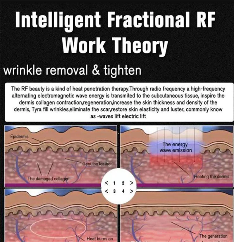 Профессиональные дробные матричный радиочастотный косметический подтяжки кожи и лифтинг удаление морщин тела Уход красота оборудование