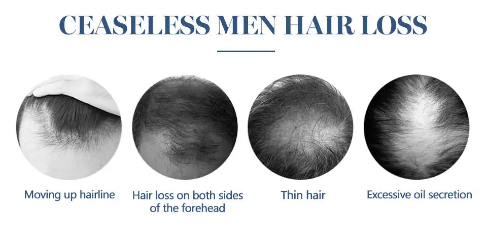 Óleo da Essência do Crescimento do Cabelo Tratamento da Perda de Cabelo para o Reparo do Óleo do Crescimento da Barba Raízes do Cabelo Produtos dos Cuidados com o Cabelo Anti Barba Dano Tônico da 7 Cheap Prod. perda cab. masc.