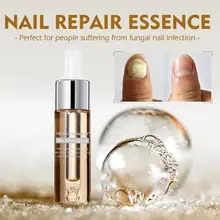 Nail Repair Serum Nail Care Treatment Fungus Onychomycosis Removal Nail Toe Belvedere Extract Nourishing Cuticle Oil