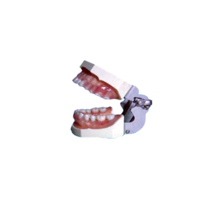 

Teaching Model Tooth Disease Pathological Anatomical Model of Teeth Caries Gingival Medical