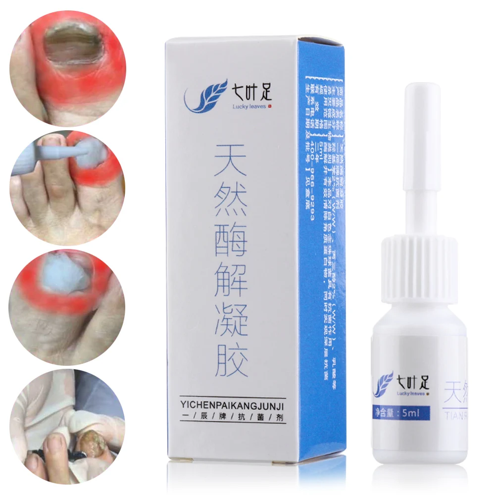 5 ml Nails Care Nail Fungal Treatment Beauty Manicure Anti Fungus Repair Liquid Health Care Bright Nail Repair Tools