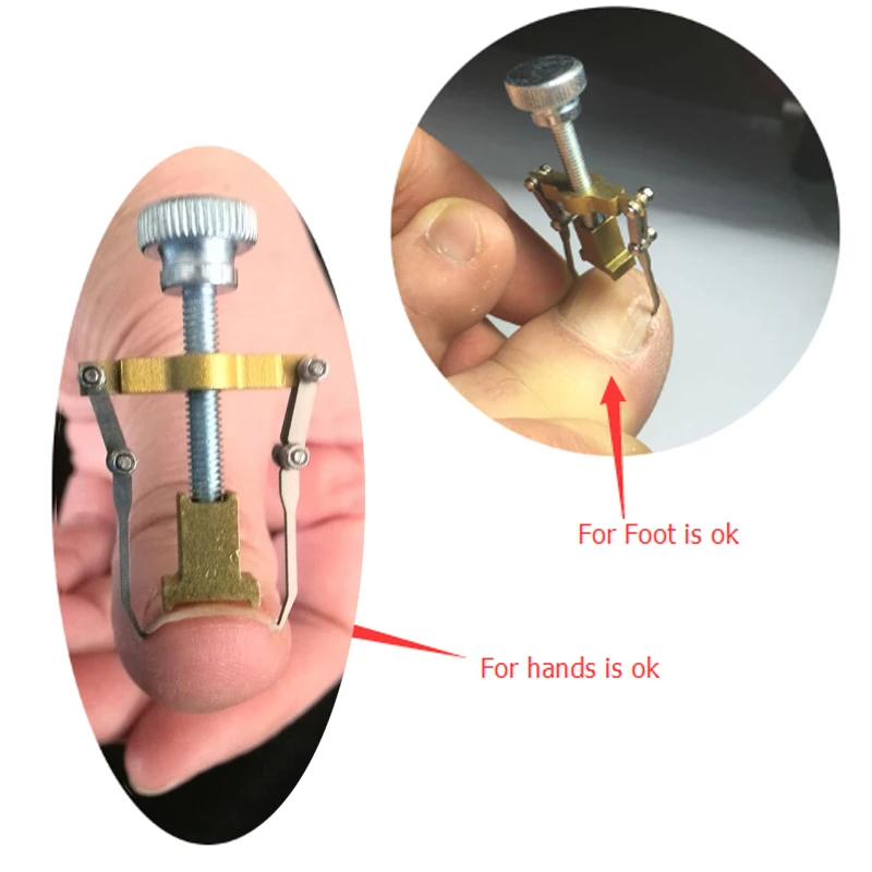 2016 NEW HOT ingrown nail hallux valgus bunion corrector pedicure cuidado de los pies alluce valgo pedicure tools