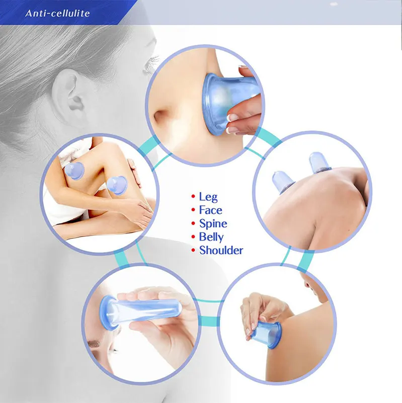 cupping  (2)