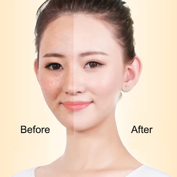 

Whitening Face Cream Dark Spot Remover Anti Aging Skin Lightening Moisturizing 669