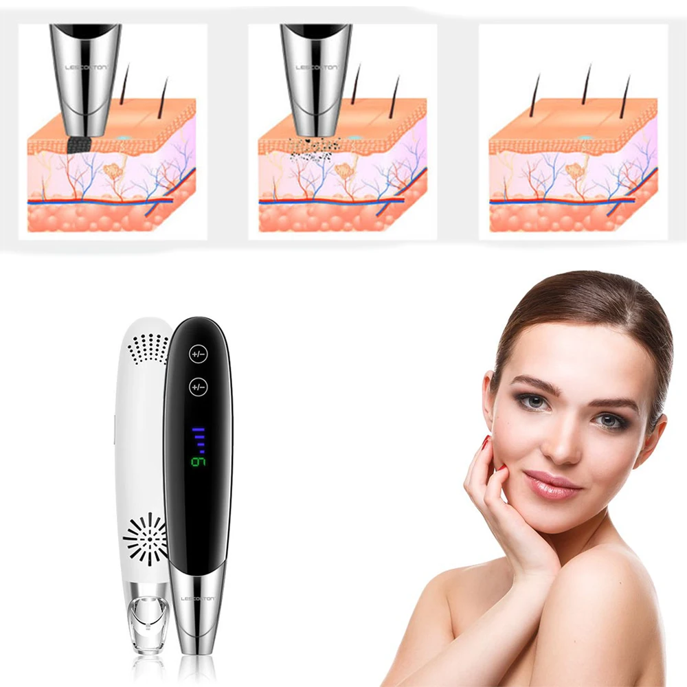 

Complete Laser Picosecond Pen for Tattoo Removal Black Pen for Scar Pigment Mole Remover Freckle Tattoo Removal Pen Beauty Laser