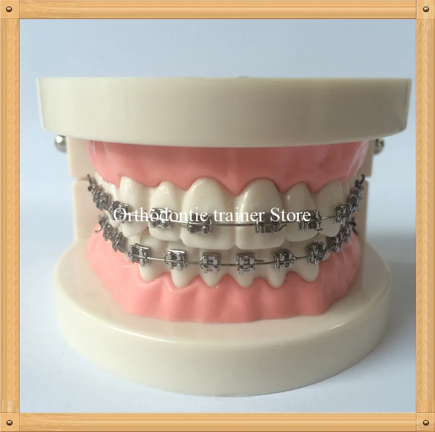 Orthodontic teeth model-7