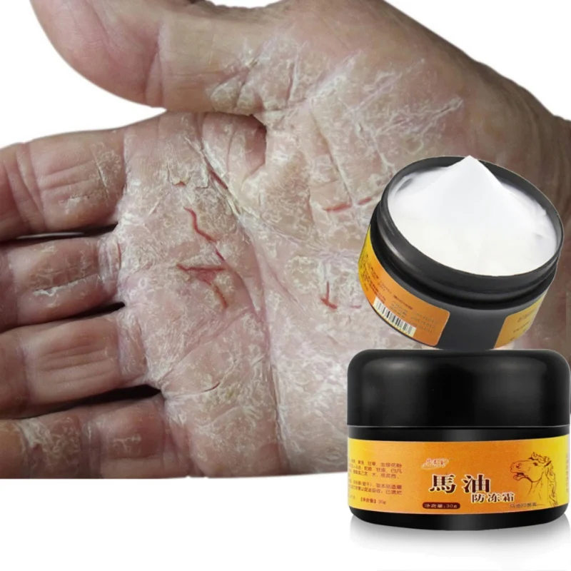 Horse Oil Foot Hand Antifreeze Cream Treatment Dry Skin Heel Chapped Peeling Repair Beauty Skin Care Products