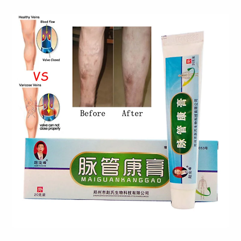

Varicose Veins Ointment Eins Varicose Treatment Plaster Varicose Veins Cure Patch Vasculitis Natural Solution Herbal Patches