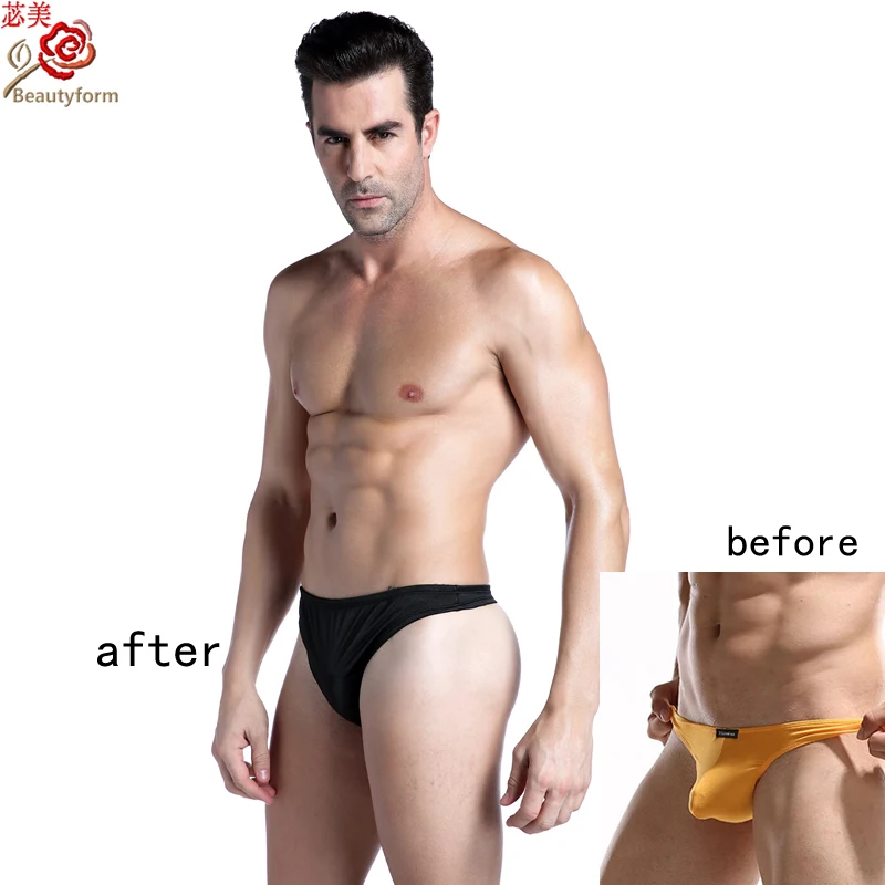 4201 000