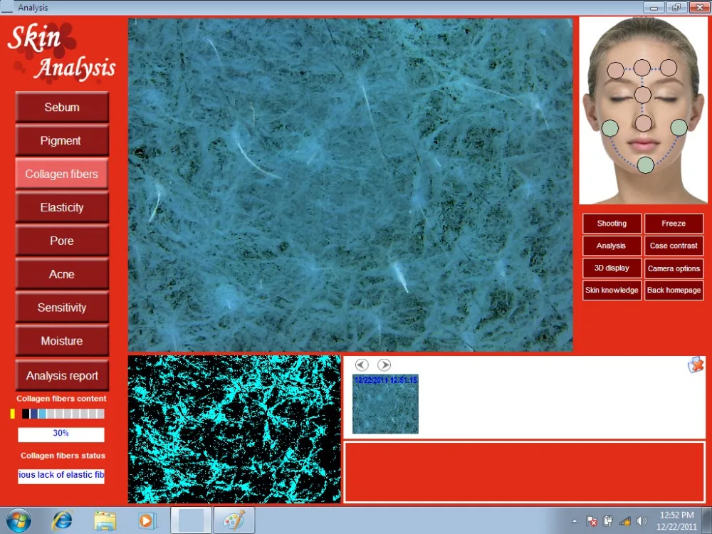 3D Skin scope11