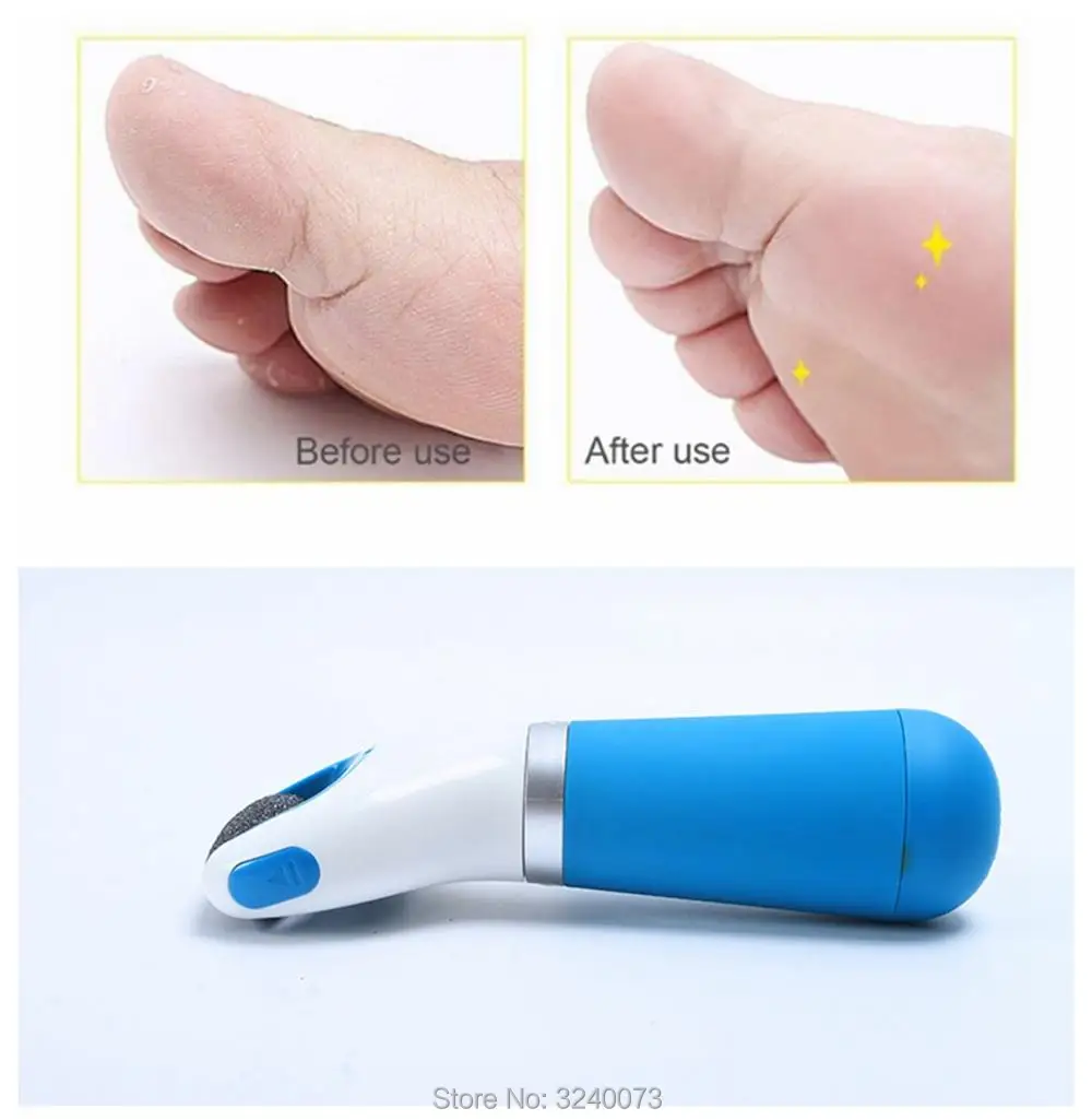 

Foot Care Pedicure Electric Grinding Foot machine Pedicure Dead Cuticle Skin Remover Tool Feet File Eel Remover rq10 rq11 Shaver