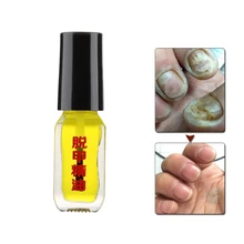 1 бутылка 5 мл удаление грибка жидкий экстракт Лечение ногтей от грибка яркий ремонт ногтей анти-инфекция Уход за ногами Onychomycosis