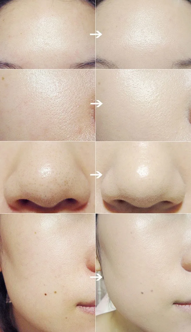 face cleaner 7