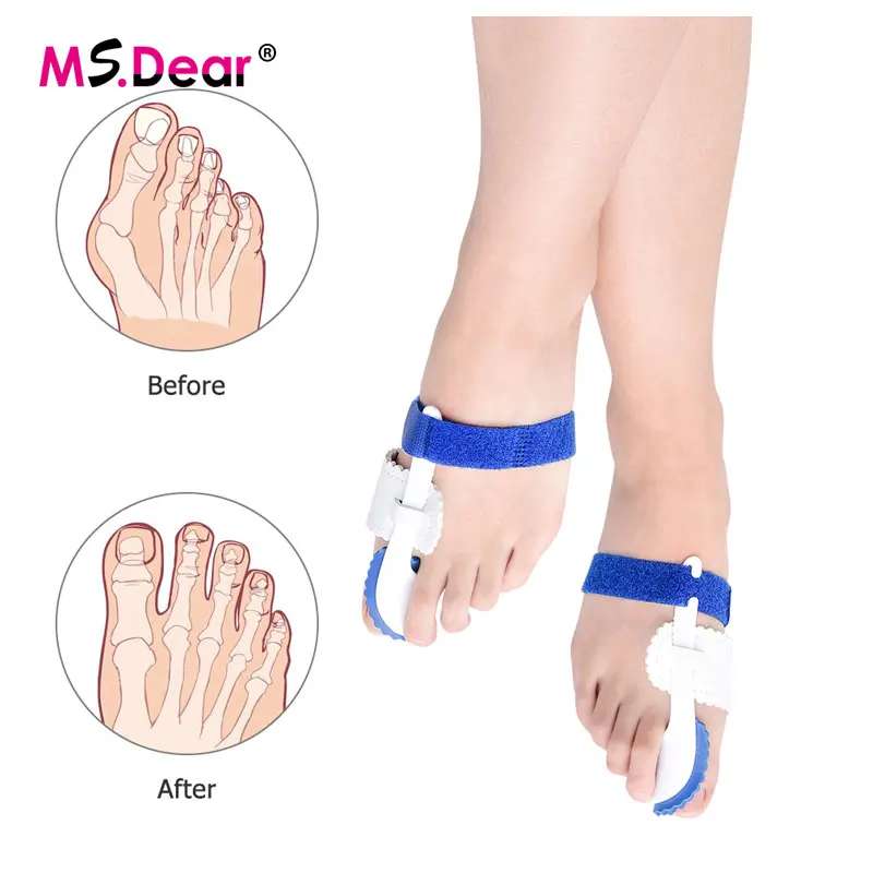 1Pair Foot Thumb Corrector Of The Big Toe Bunion Corrector