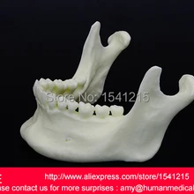 Стоматологические материалы патологическая модель рассечения кариозный зуб гингивал имитационная модель mandibulal TEETH-GASEN-DEN030