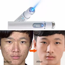 Синяя светотерапия от акне лазерная ручка портативный аппарат для избавления от морщин прочное мягкое устройство для удаления шрамов терапия ручка уход за кожей лица