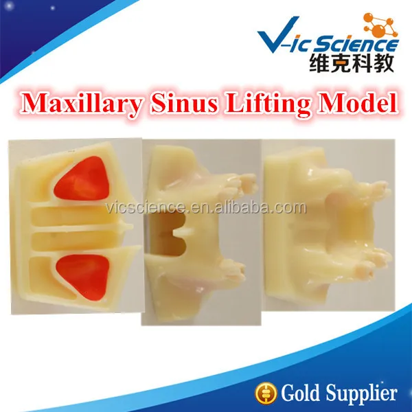 Maxillary Sinus поднимающаяся модель/Maxillary Sinus Lifting