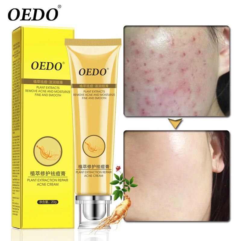 

OEDO Beauty Plant Extraction Face Cream Serum Ginseng Extract Ance Acne Scar Removal Cream Treatment Whitening Cream Skin Care