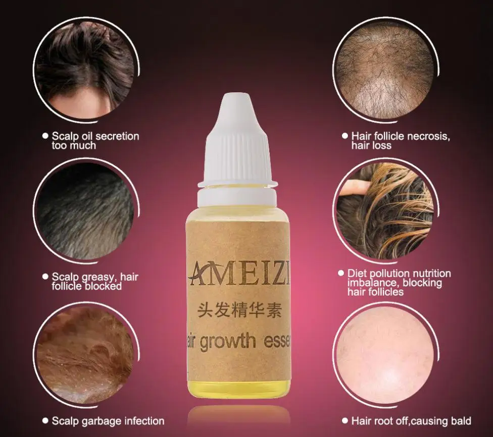 

AIMEIZII 20ml Hair Growth Essence Hair Loss Liquid Natural Pure Original Essential Oil Dense Hair Grow fast Health Care product