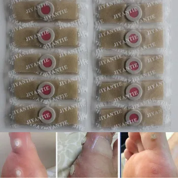 

100Pcs/lot Exfoliating Corn Foot Patch Soft Feet Problem Remove Hard Dead Skin Treatment Removed Foot corn removal Calluses Away