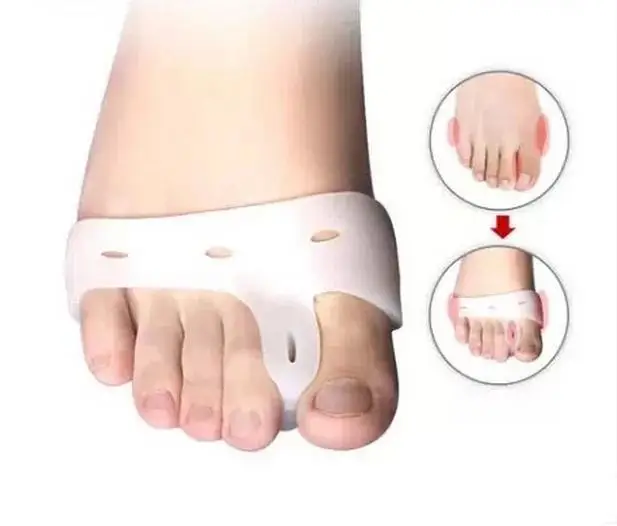 

1pair=2pics Genuine new special hallux valgus bicyclic thumb orthopedic braces to correct daily silicone toe big bone