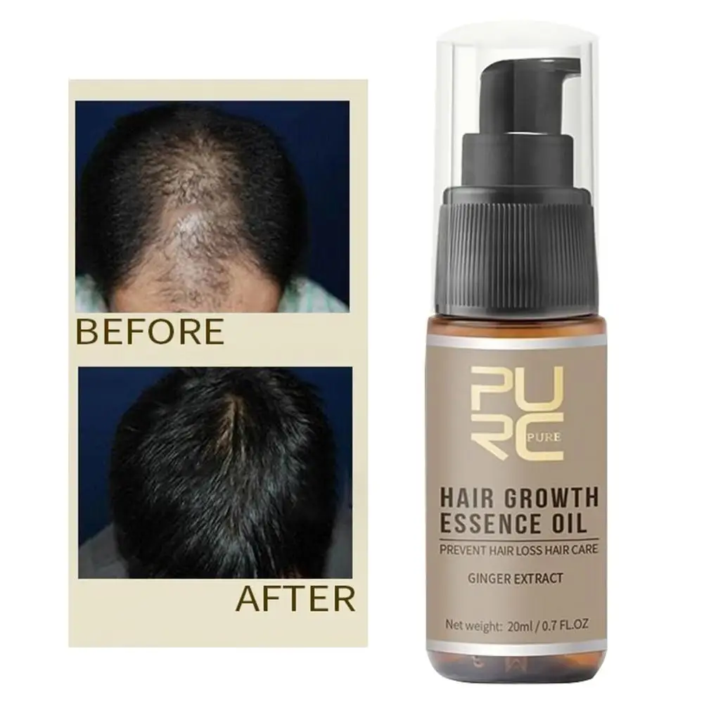 

20ml Hair Growth Essence Anti Loss Spray Nutritious Oil Control Scalp Treatment beauty