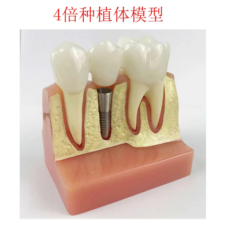 Человека устные зубы модель человеческие зубы анатомическая модель анатомические Зубы Модель медицинский анатомический модели