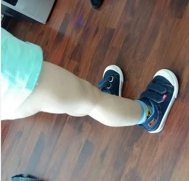 1 (4)