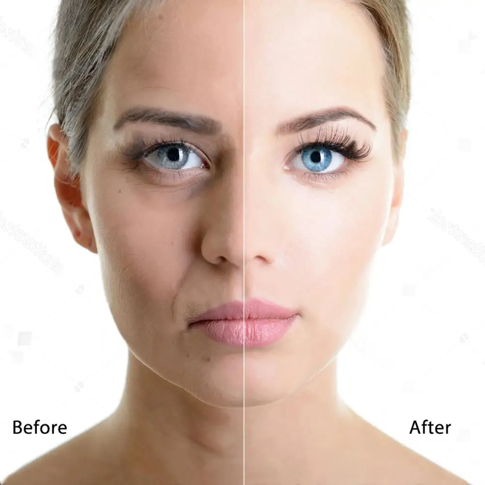  Ultrasonic Face Scruber Skin Tightening Pore Shrink Cleaning Machine Facial Lifting Blackhead Remov