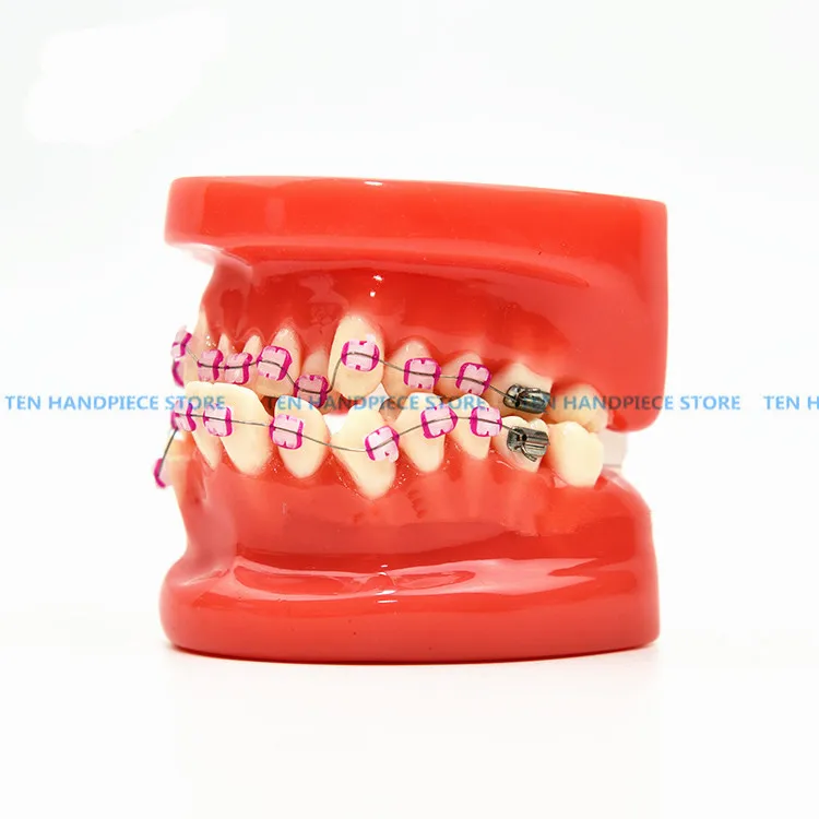 Новая Ортодонтическая модель зуба с керамическим кронштейном модель доктора пациента коммуникационная модель обучения стоматологические материалы
